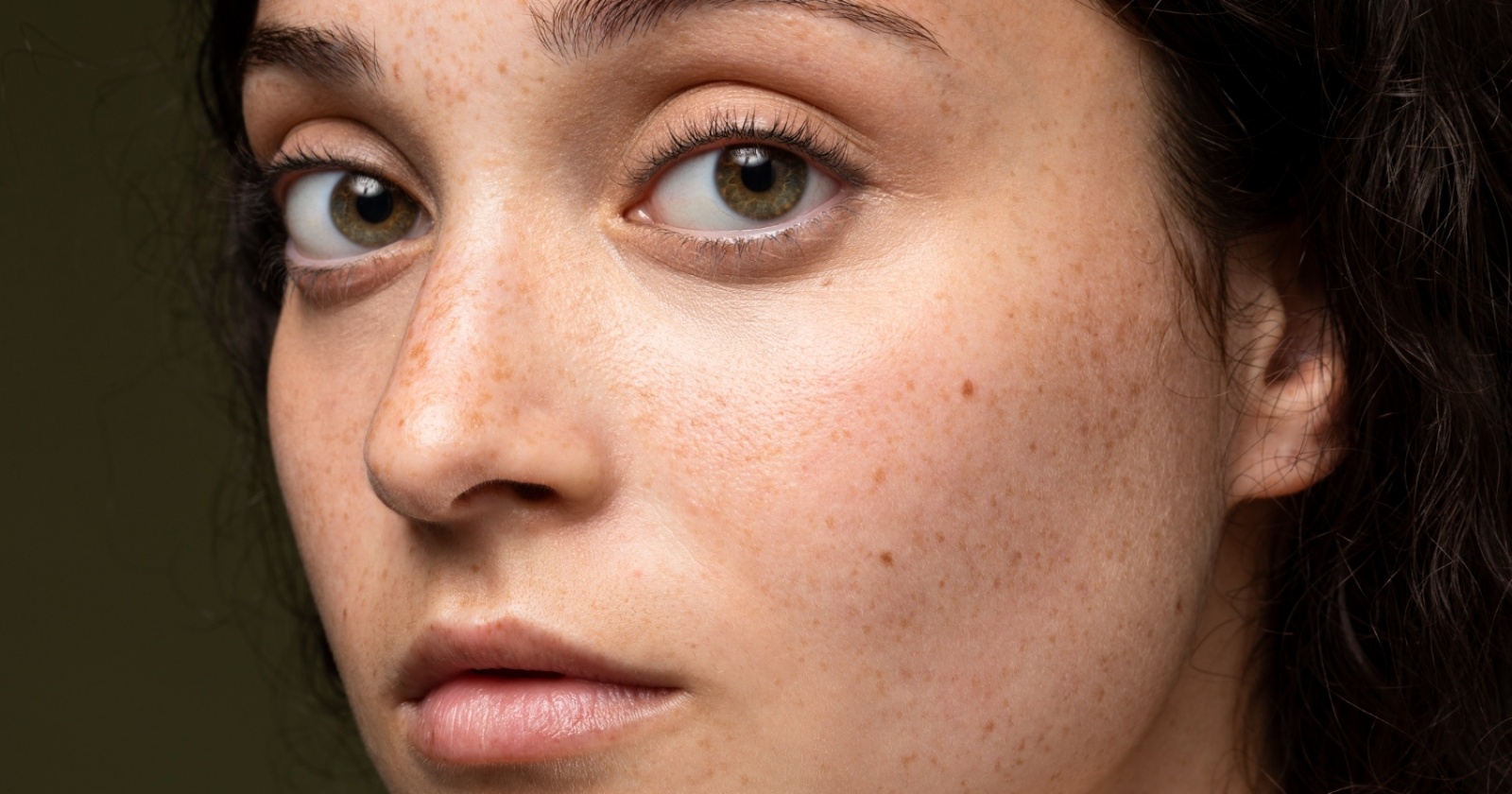 skincare flek hitam - ilustrasi berita Perkembangan skincare flek hitam yang Perlu Diketahui